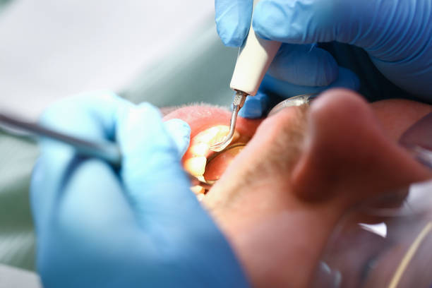 Best Weekend Emergency Dentist in Barton Creek, TX
