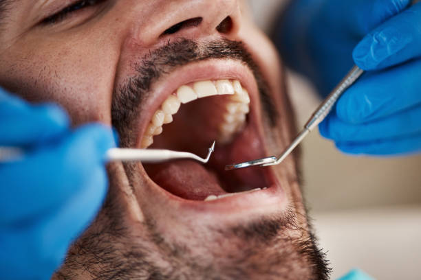 Best Broken or Cracked Tooth Emergency Dentist in Barton Creek, TX